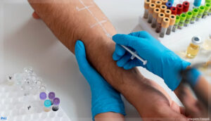 Imunoterapia celular mira mutação comum do câncer humano