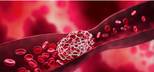 Trombofilias – por Rafaela Windy